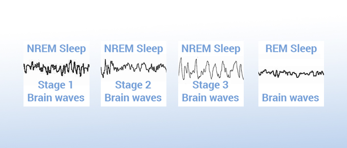 What the brain waves of each stage of sleep looks like